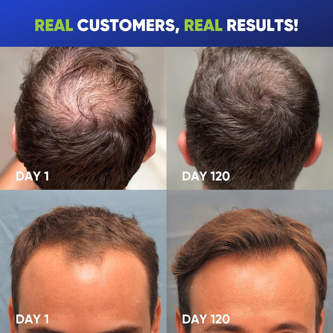 Hair Growth Shampoo for Men