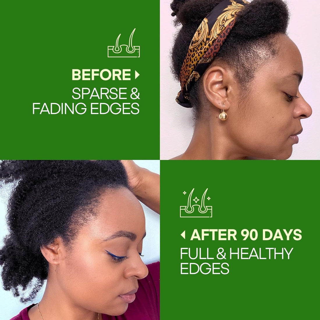 Batana Oil for Hair Growth