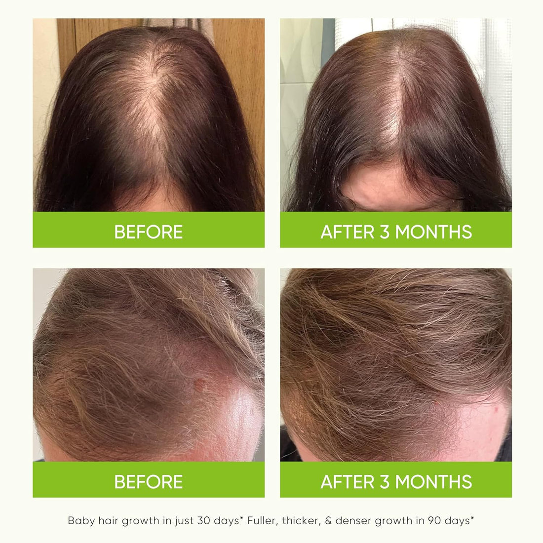 Hair Growth Serum Spray 80 ml