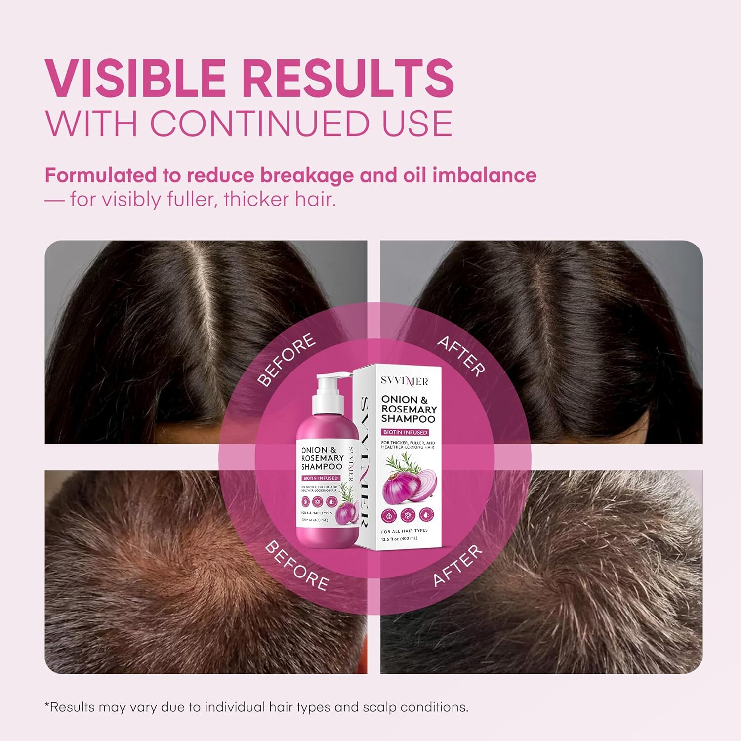 Svvimer Onion Rosemary and Biotin Shampoo - Hair Growth Shampoo for Hair Loss and Thinning