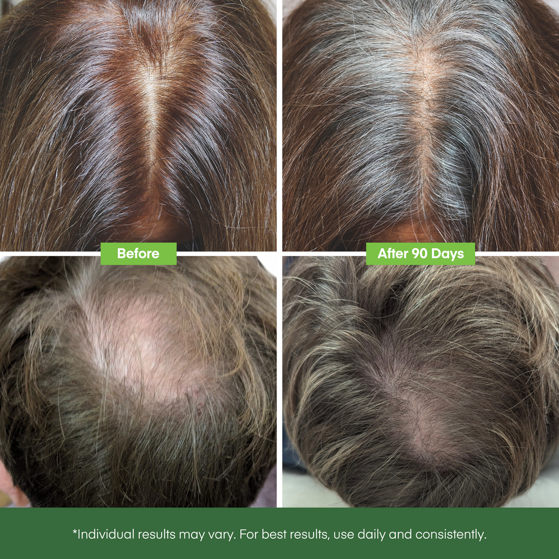 Svvimer Hair Growth Serum Roll On - with Rosemary Batana Oil Biotin Thickening Scalp Serum for Thinning Hair and Loss - for Women and Men 2 PCS 15ml/each